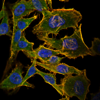 COQ8A Antibody