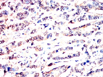 ACHE Antibody