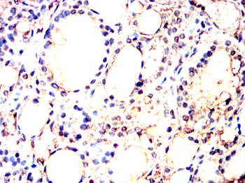 ACHE Antibody