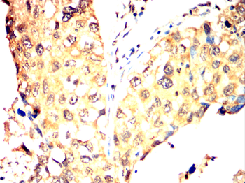 CNN1 Antibody