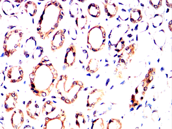 NFKB1 Antibody