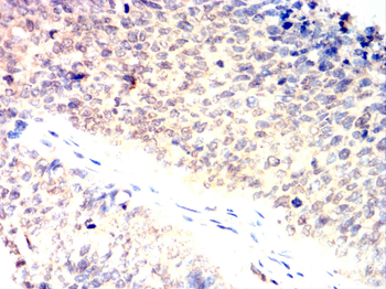 NFKB1 Antibody