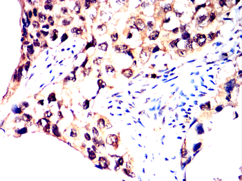 HSPB8 Antibody