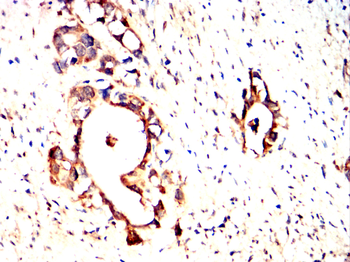 GCLM Antibody