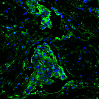 PFKP Antibody