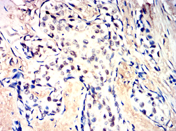 RAD23B Antibody