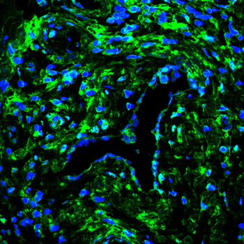 RAD23B Antibody