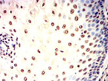 RAD23B Antibody