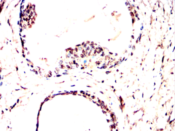 RAD23B Antibody
