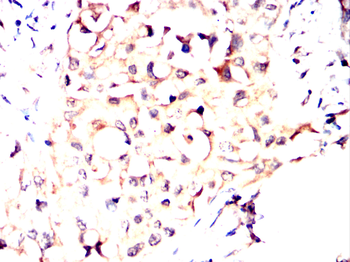 GLS2 Antibody