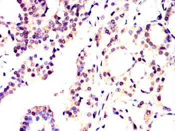 SMARCA4 Antibody