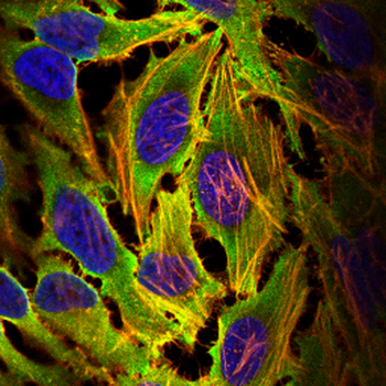 FASN Antibody