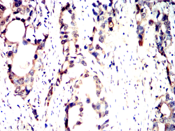 HP Antibody