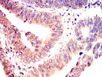 RPS6KB2 Antibody
