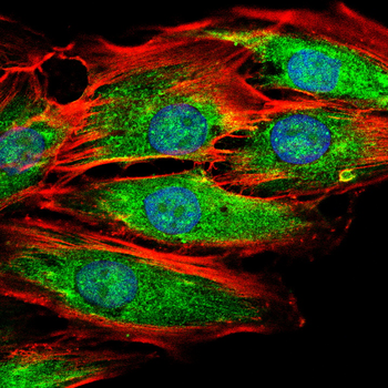 TGM2 Antibody