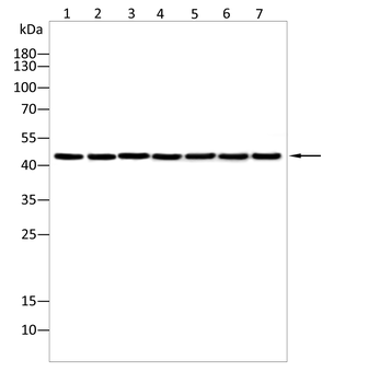 SERPINB3 Antibody