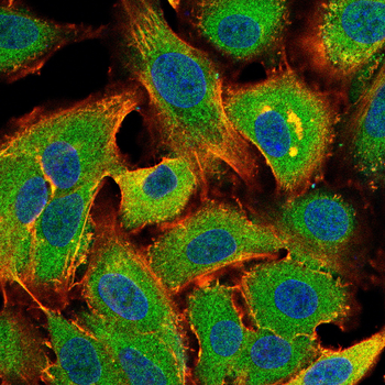 CNOT4 Rabbit Polyclonal Antibody
