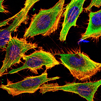 FKBP5 Antibody