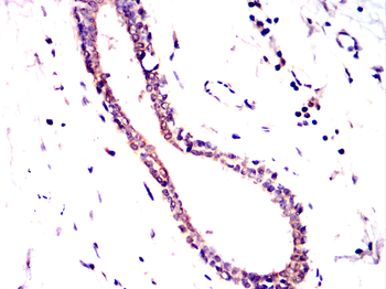 FDPS Antibody