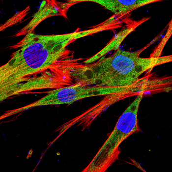 CRY2 Antibody