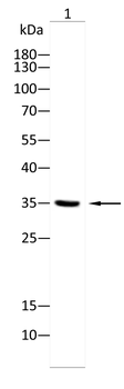 FN3K Antibody
