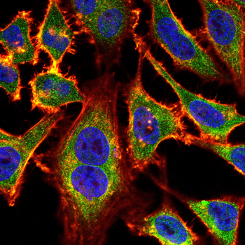 APCS Antibody