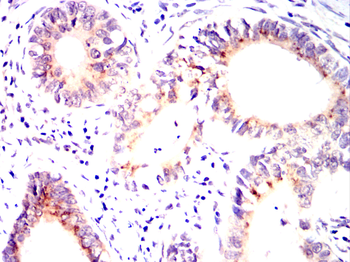 ARSA Antibody