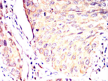 CHRM2 Antibody