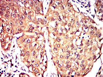 LIMK1 Antibody