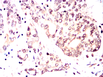 THOC1 Antibody