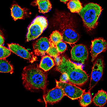 TPX2 Antibody