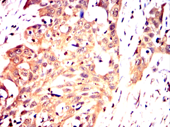 STK39 Antibody