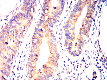 STK39 Antibody