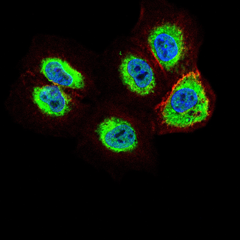 SOCS3 Rabbit Polyclonal Antibody