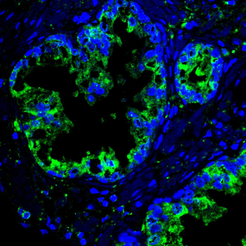 P4HB Antibody