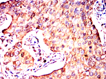 P4HB Antibody