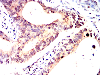 RUVBL1 Antibody