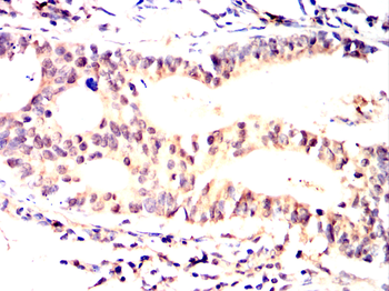 AKT2 Antibody