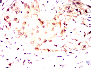 UCHL5 Antibody