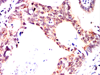 UCHL5 Antibody