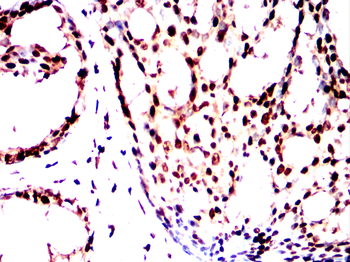 YEATS4 Rabbit Polyclonal Antibody