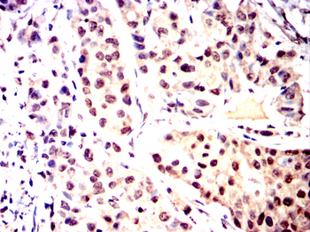 YEATS4 Rabbit Polyclonal Antibody