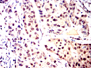YEATS4 Rabbit Polyclonal Antibody