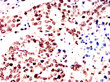 YEATS4 Rabbit Polyclonal Antibody