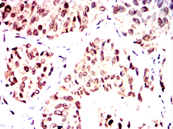 YEATS4 Rabbit Polyclonal Antibody