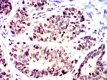 YEATS4 Rabbit Polyclonal Antibody