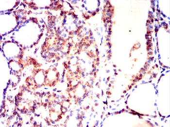 ACADM Antibody