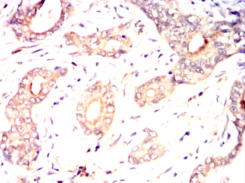ITGB5 Antibody