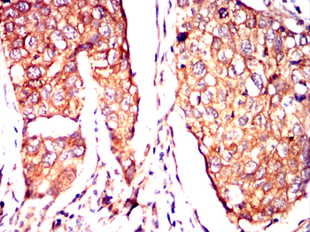 ITGB5 Antibody