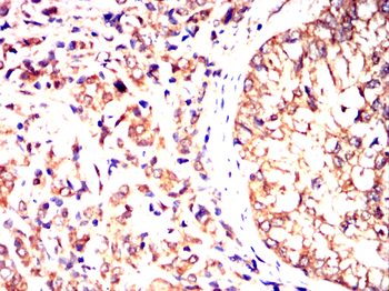 TRBC1 Antibody